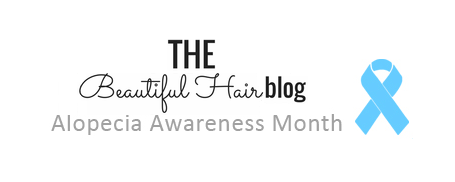 We Have Our Winners For The Alopecia Contest